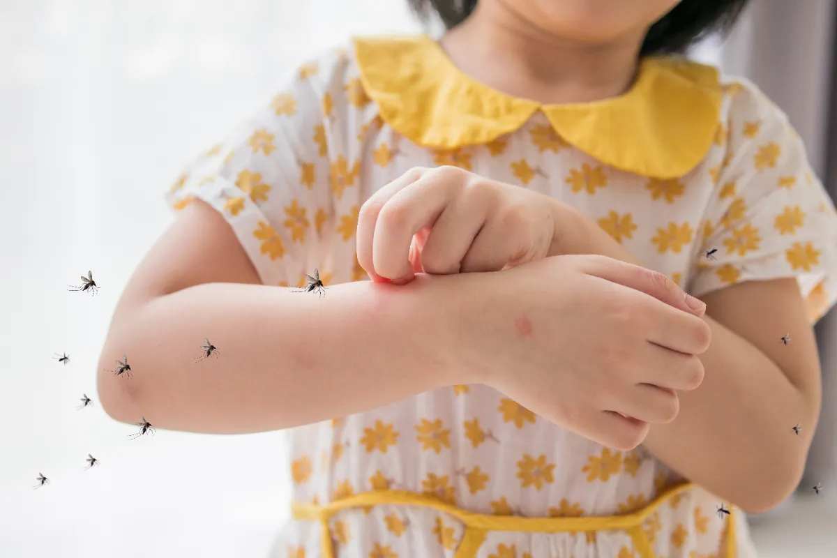 Naturliga sätt att hantera insektsbett